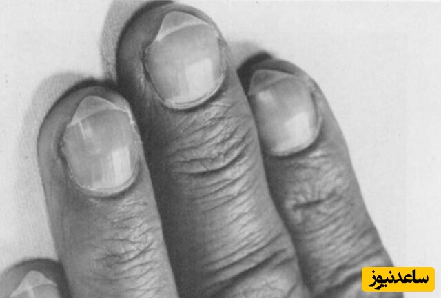 برندگان «نوبل مضحک» 2025 اعلام شدند