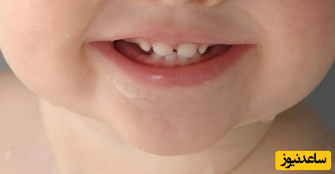 کودکان تا چند سالگی دندان در می آورند؟ اولین دندان کدام دندان است؟