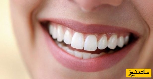 علل لق شدن دندان ها در بزرگسالان چیست؟