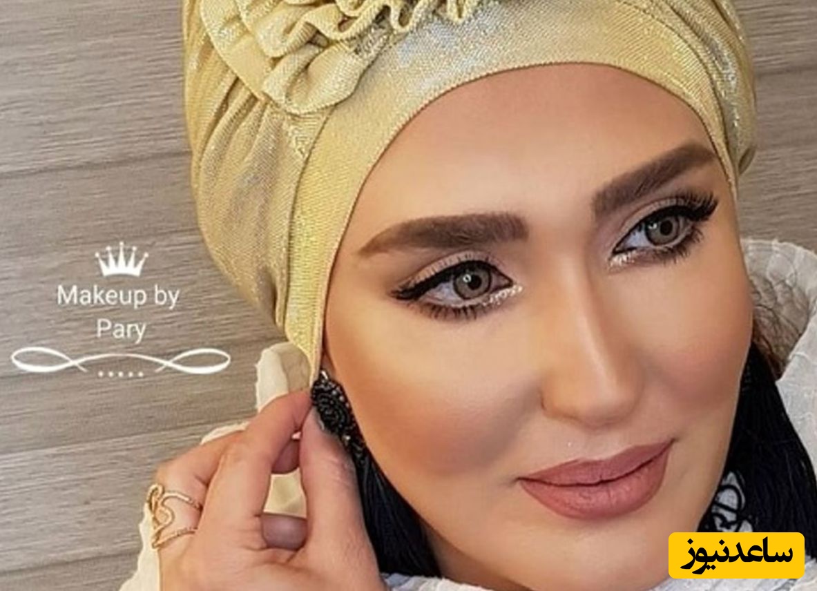 چهره ناهمگون زهره فکر در اثر انجام عمل های زیبای متوالی!