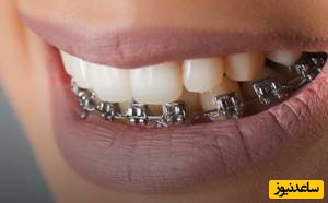 آشنایی با اورژانس ارتودنسی