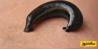 دیدن زالو در خواب چه تعبیری دارد؟ / تعبیر خواب زالو