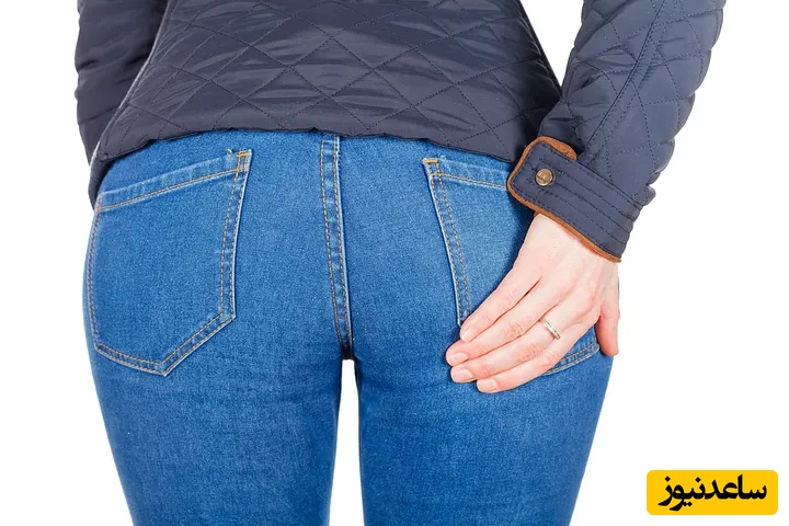 درمان قطعی جوش روی باسن؛ بهترین روش‌های پزشکی و خانگی