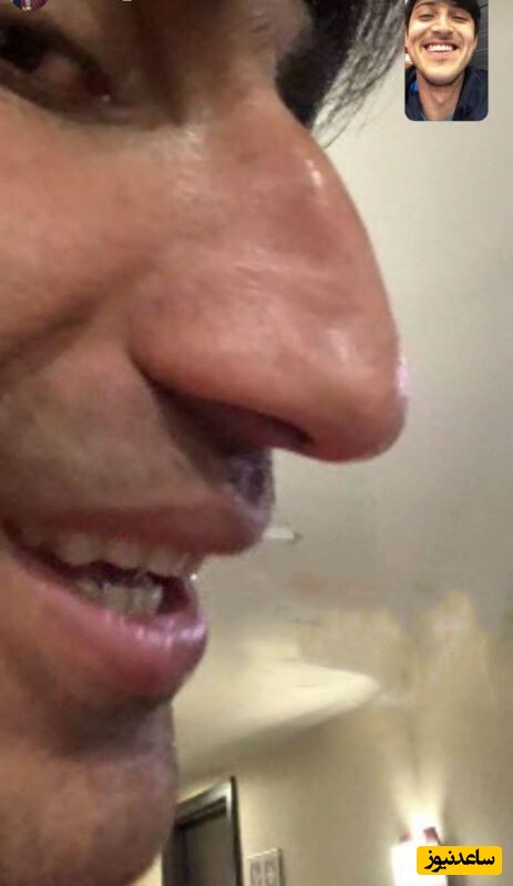 علیرضا بیرانوند: دوست دارم بینیم رو عمل کنم اما همسرم اجازه نمیده، بینی من مثل آهنه بچه‌ها سر تمرین با پا روش راه میرن و...