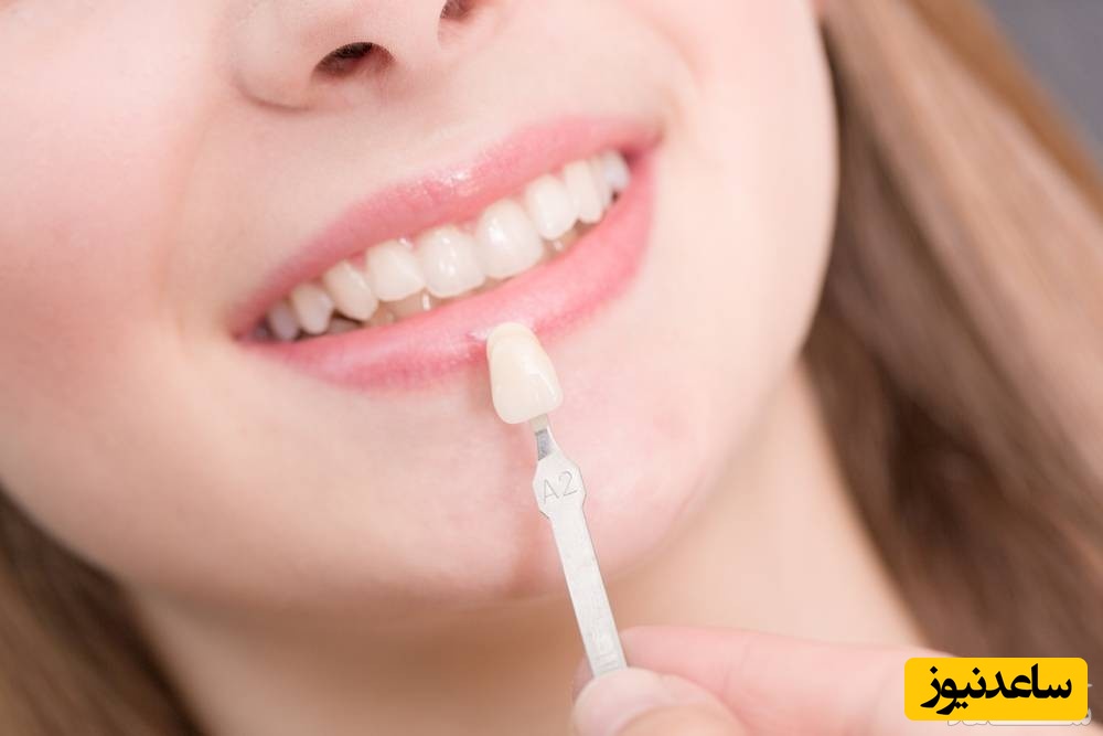 عوارض روکش دندان چیست؟