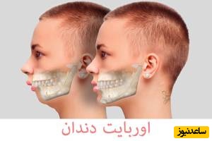 اور‌بایت + نکات مهم