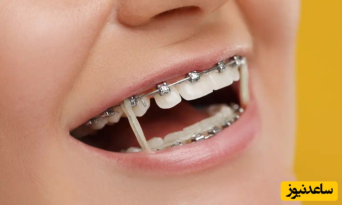متخصص ارتودنسی و دندانپزشک چه شباهت ها و چه تفاوت هایی دارند؟