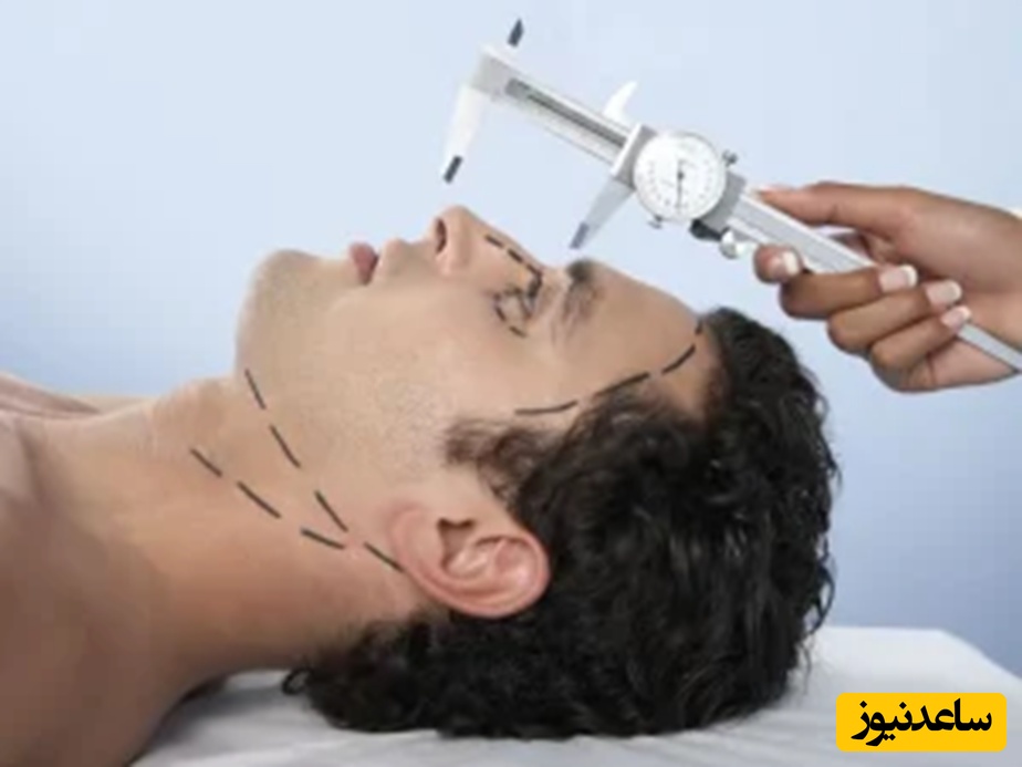 چرا انتخاب پزشک مناسب برای رینو پلاسی اهمیت دارد؟