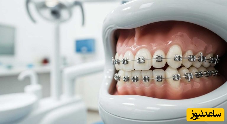 اورجت چیست؟