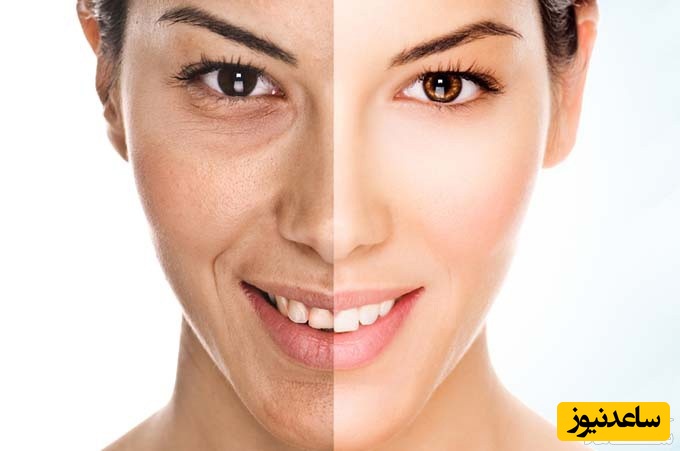 هرآنچه باید درباره ترمیم جای سوختگی با لیزر بدانید