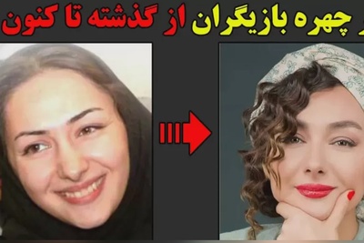 وقتی پول معجزه می‌کند؛ تغییر چهره 180 درجه‌ای  بازیگران زن مشهور بعد از عملهای زیبایی؛ سحر دولتشاهی، الناز حبیبی، نیوشا ضیغمی و...+ویدیو