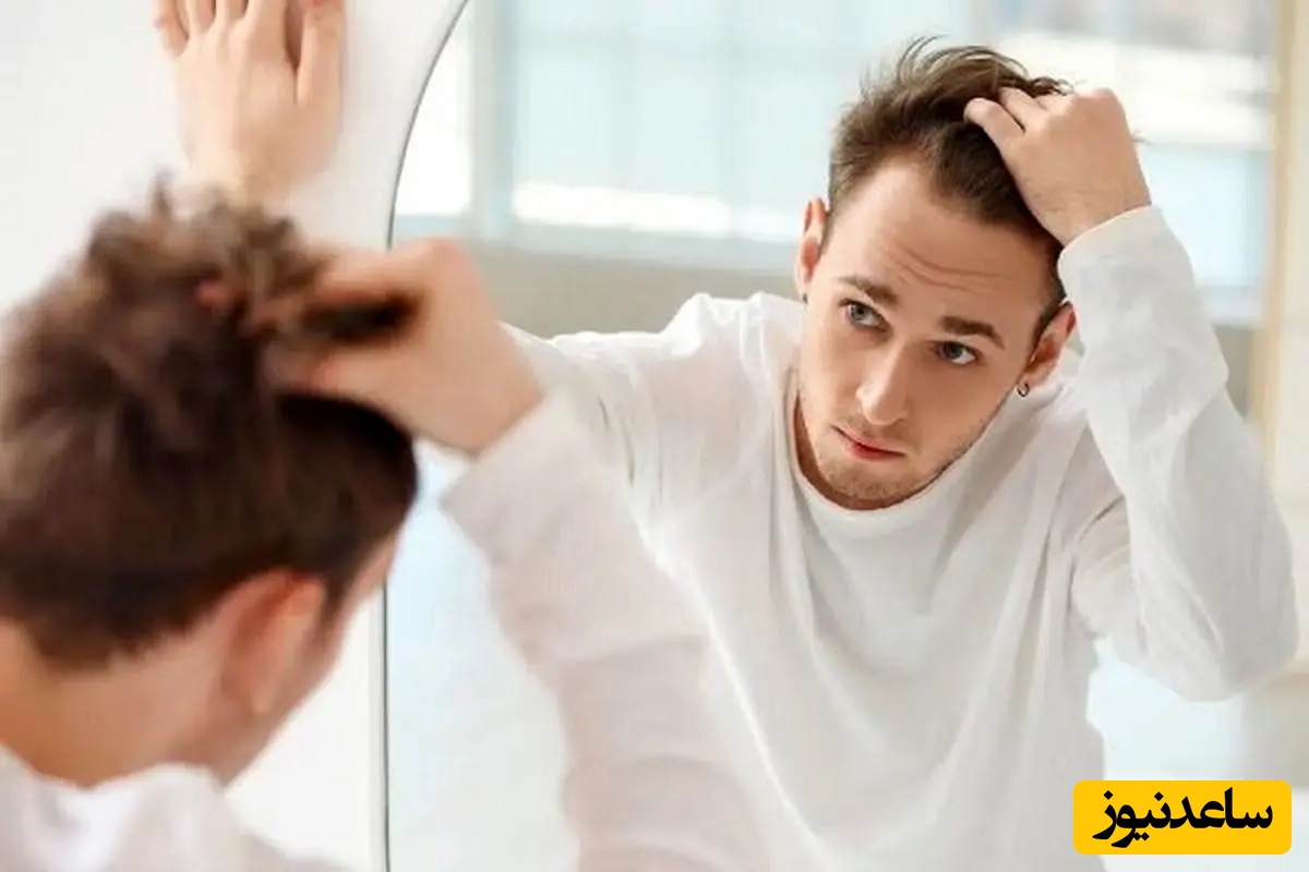 این خوراکی‌ها باعث ریزش مو می‌شوند