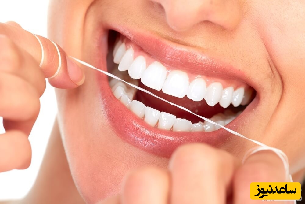 ایمپلنت بدون جراحی چگونه انجام می‌ شود؟