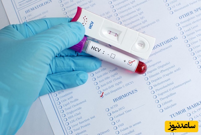 هر آنچه باید درباره مصرف ایمن تلاپرویر و کنترل HCV بدانید