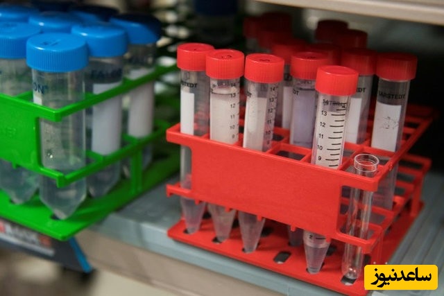 با تست ادرار از وجود سرطان باخبر شوید