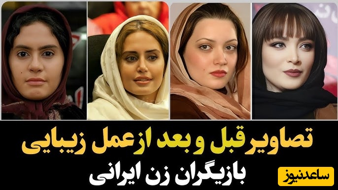 تعییر چهره باورنکردنی و هوش‌پران بازیگران زن پس از عملهای زیبایی؛ سحر دولتشاهی، الناز حبیبی، نیوشا ضیغمی و...+ویدیو