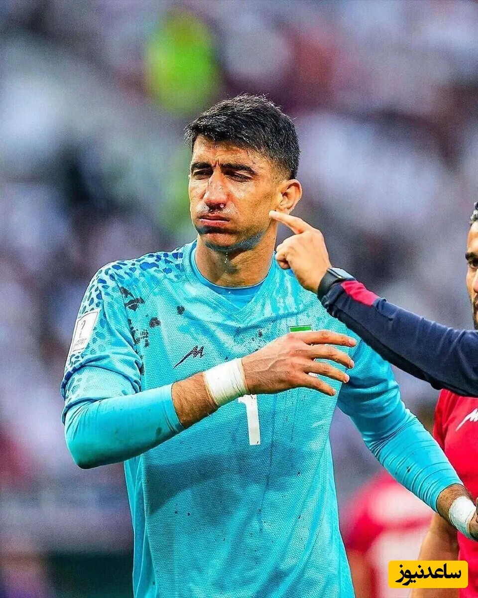 ویدیو | لحظه دلخراش نوستالژی فوتبالیست؛ مصدومیت شدید علیرضا بیرانوند / با اون همه درد میخواست بازی رو ادامه بده!