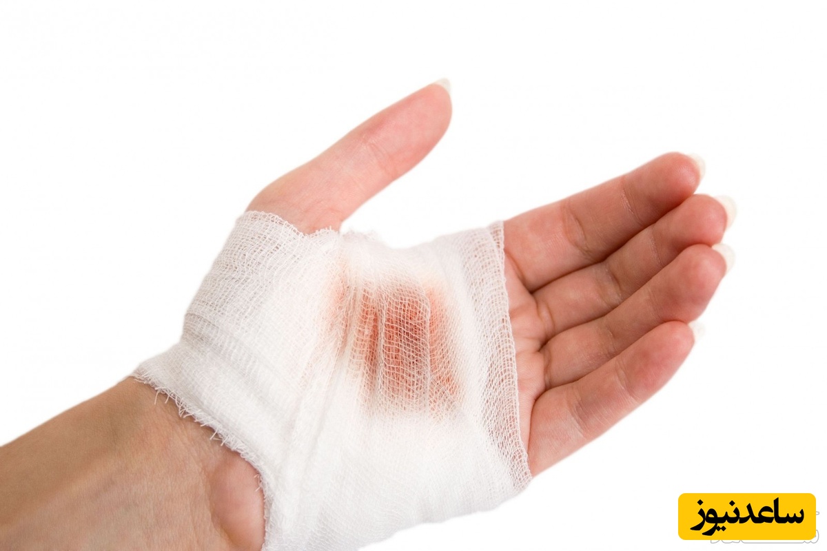 هرآنچه باید درباره دیه دامیه بدانید