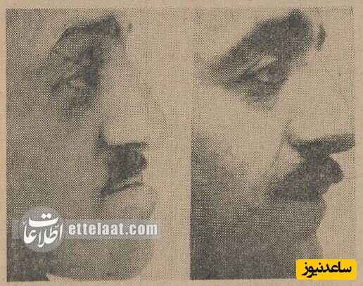 اولین عمل زیبایی ایران