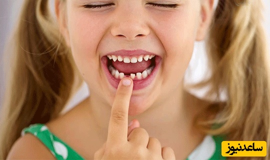 سوالات متداول در مورد ترمیم دندان شیری
