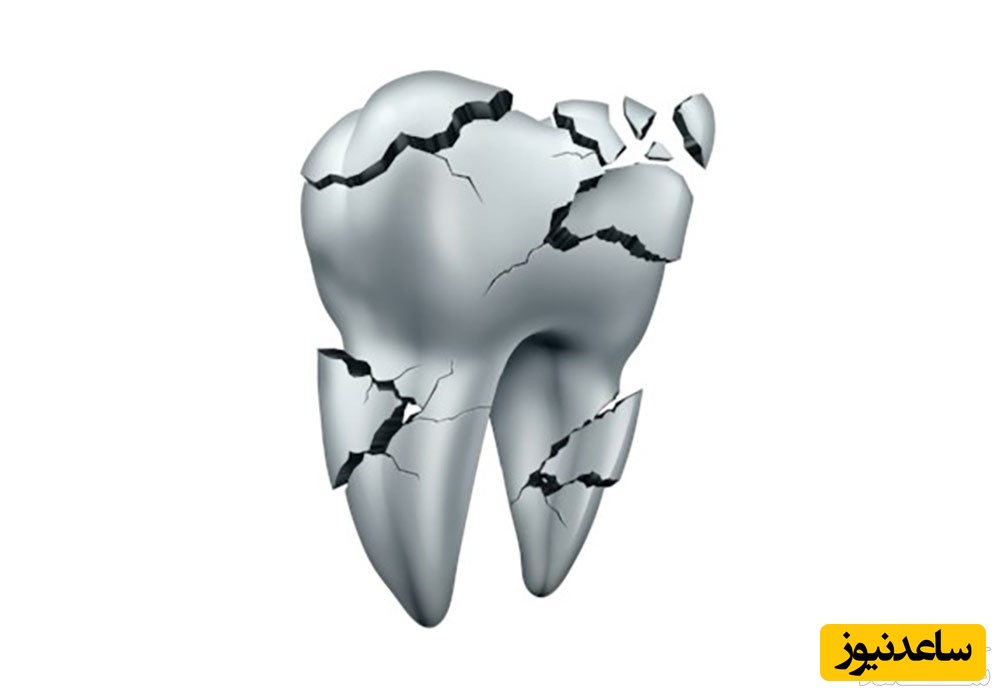 آیا مینای دندان را می توان ترمیم کرد