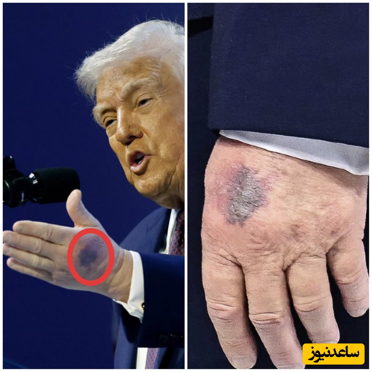 ببینید| بمب تازه درباره وضعیت جسمانی ترامپ؛ پزشک CNN پرده از یک ابهام برداشت!