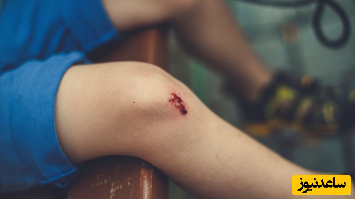 چرا بعضی از بچه ها از خون می ترسند؟