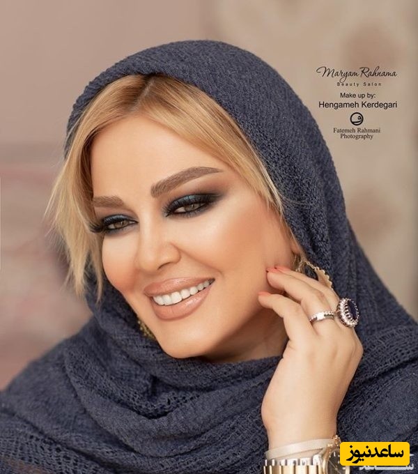 بهاه رهنما بازهم جنجالی شد +عکس / تغییر چهره خانم بازیگر شوکه کننده است