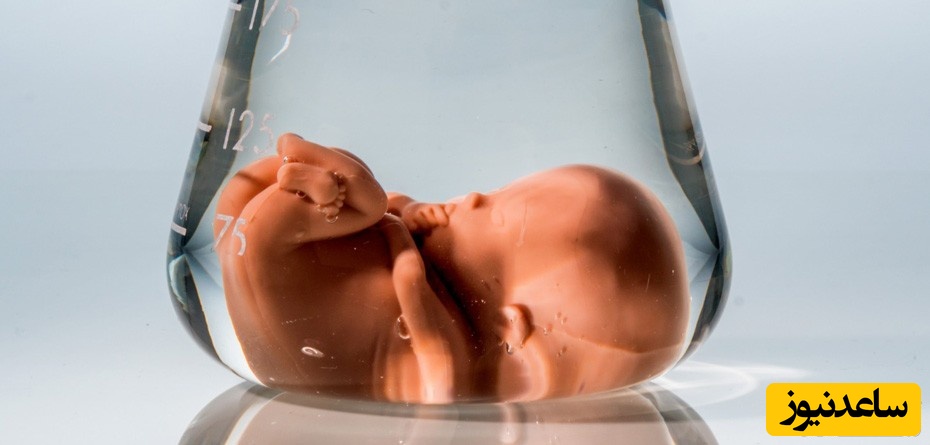 علل و علایم نشت مایع آمنیوتیک در دوران بارداری