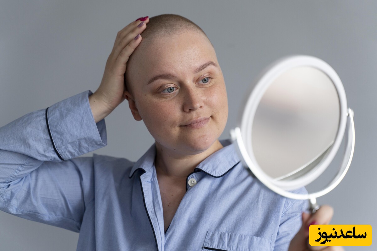 کلینیک کاشت مو زنان در تهران | کلینیک نیل فروش زاده