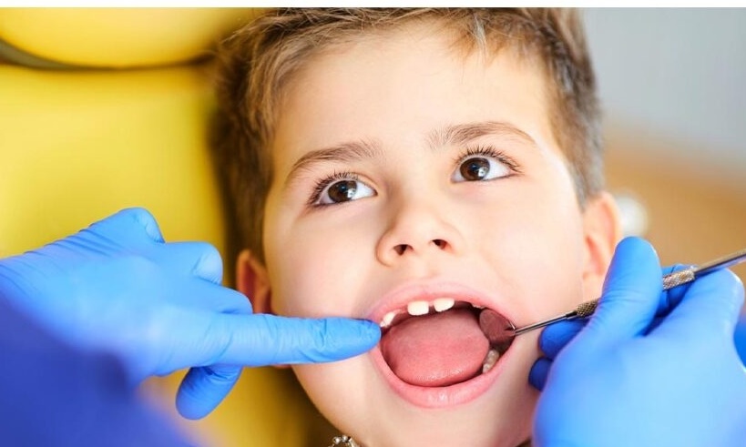 لوازم ارتودنسی لازم برای کودکان چیست؟