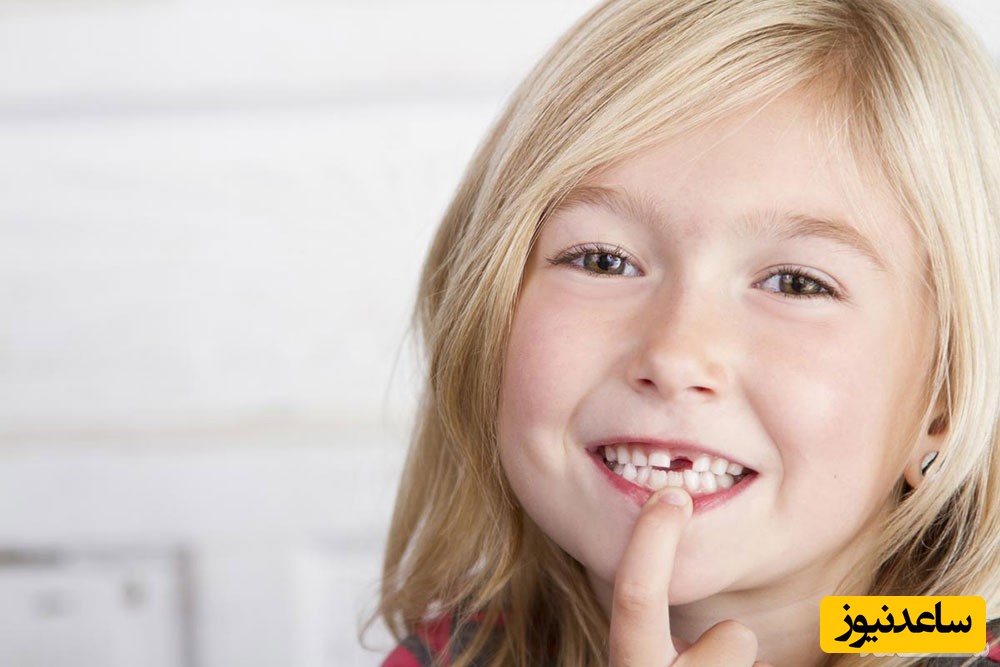 علائم وارد شدن آسیب به دندان شیری چیست و چگونه جلوگیری کنیم؟