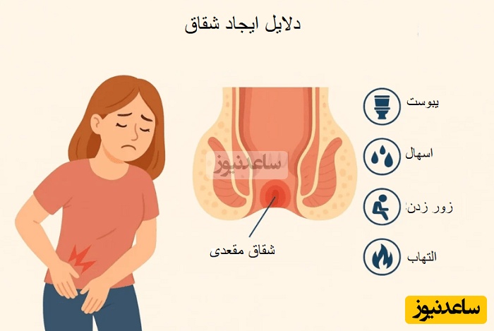 علل ایجاد شقاق