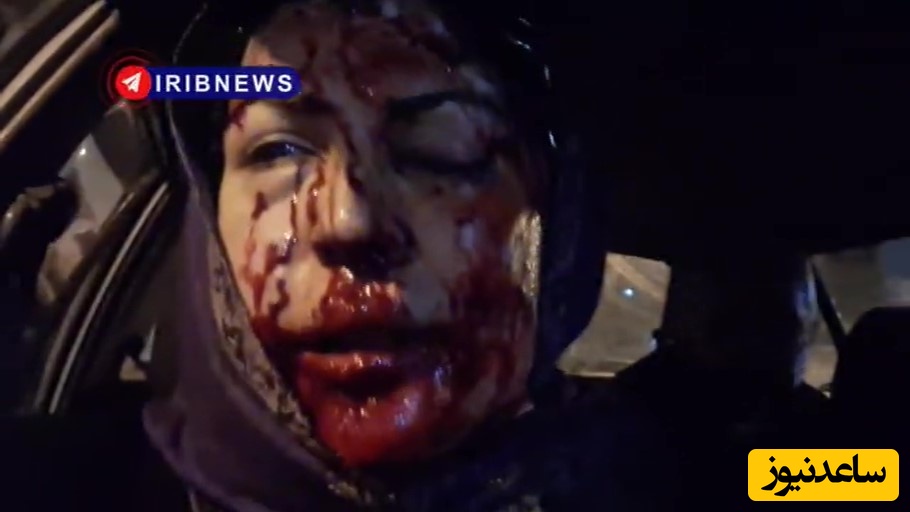 هشدار!⚠ حاوی صحنه های دلخراش: جنایت وحشتناک تروریست های پهلویچی را ببینید! با تفنگ ساچمه ای صورت و چشم خبرنگار هدف قرار داده اند!/ داعش پیش اینا کم میاره...+ویدیو