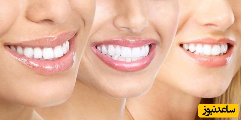 استفاده از جراحی برای درمان تحلیل لثه امکان پذیر است؟