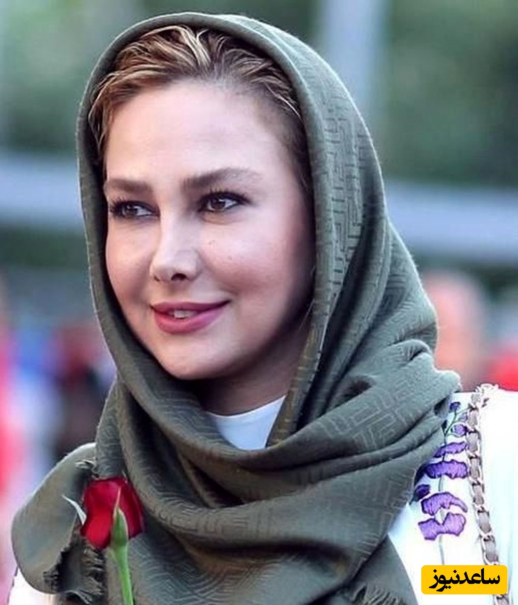 حرکت جسورانه آنا نعمتی همه رو مبهوت کرد! آنا نعمتی تصویری از چهره پر از لک و بدون آرایش  خود منتشر کرد!