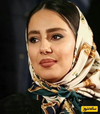 استایل تابستانی شیک و لوکس شیدا یوسفی | یه کلاه ساحلی با پیراهن زرد لیمویی | خیلی شیک و با کلاسه😍👌