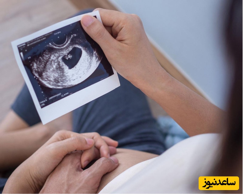 سونوگرافی بارداری