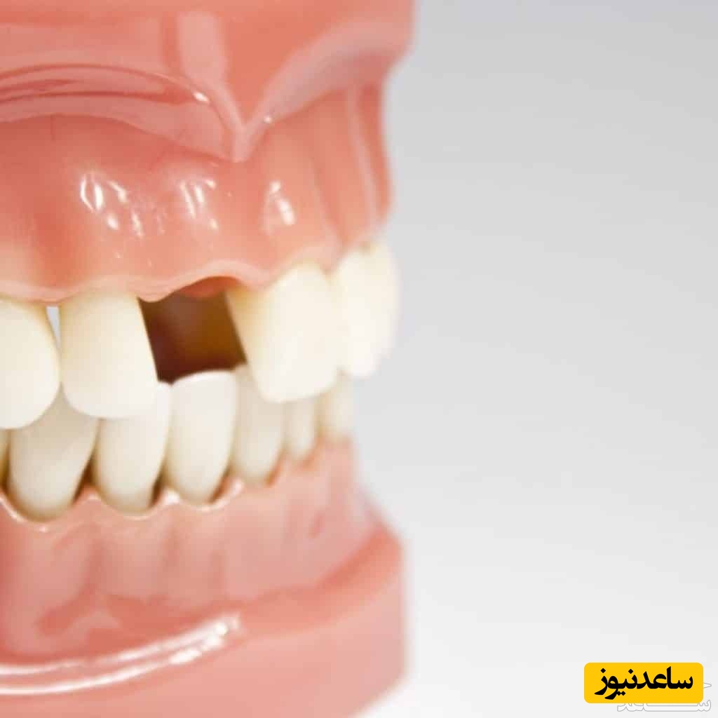 از دست دادن دندان در بزرگسالان چه مشکلاتی را در پی دارد؟