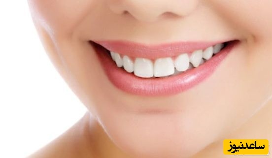 چه مواد غذایی برای دندان مضر است؟