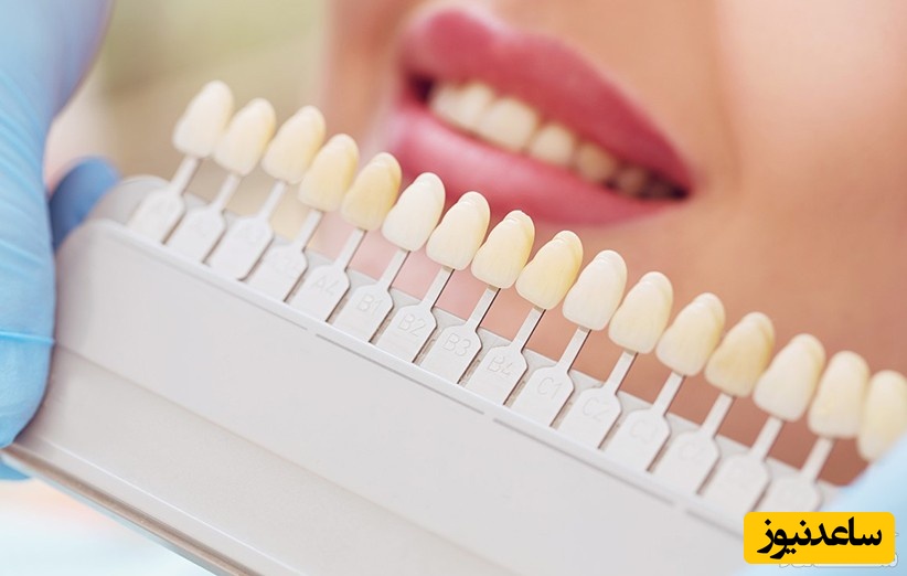 آمادگی های لازم برای ایمپلنت دندان چیست؟