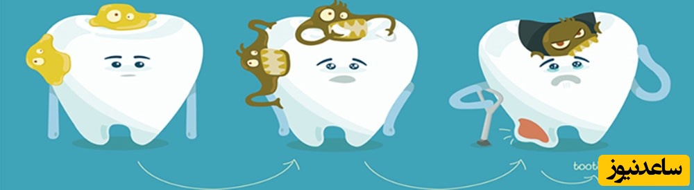 مهم‌ترین آسیب یک طرفه جویدن غذا