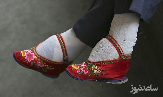 رسم عجیب کوچک کردن پای زنان ؛ زنانی با کوچک‌ترین پاهای دنیا!