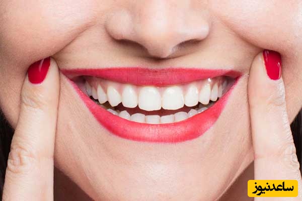 در طرح لبخند به چه نکاتی باید توجه کرد؟