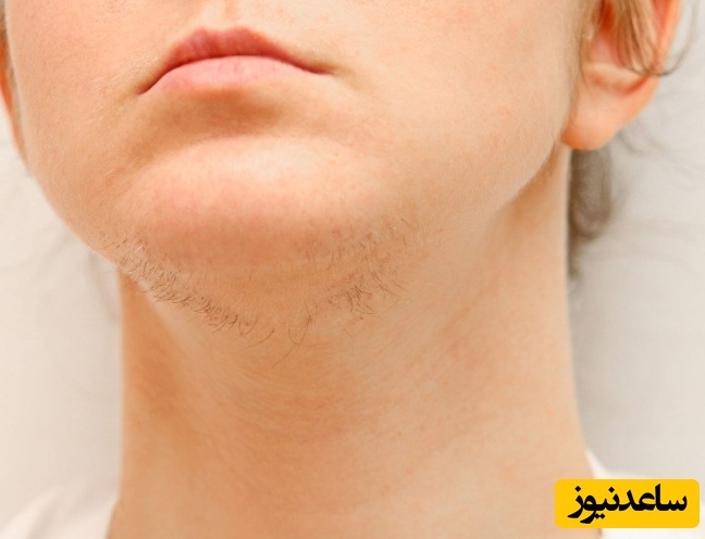 5 روش خانگی تضمینی برای رفع موهای زائد ناحیه تناسلی (بیکینی)