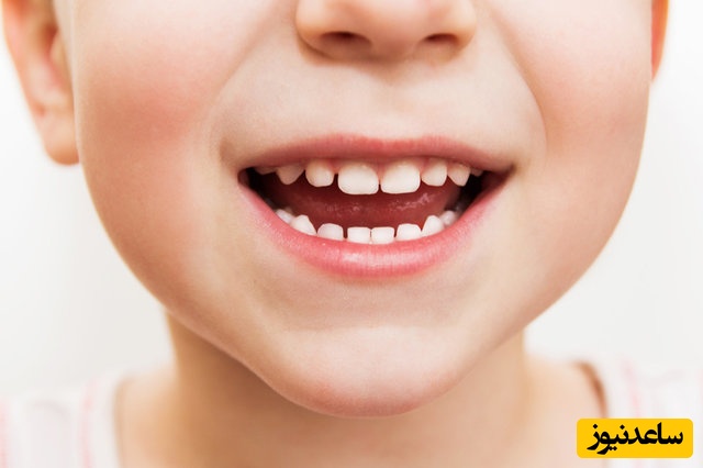 علائم عفونت دندان در کودکان + نکات مهم