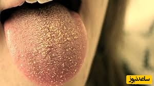 5 دلیل برای زبان سبز رنگ