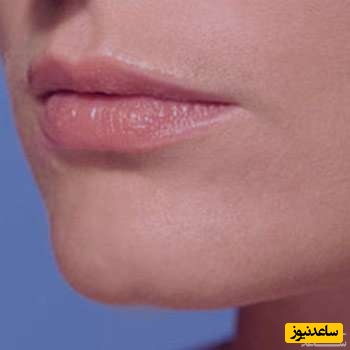 دیدن چانه در خواب چه تعبیری دارد؟ / تعبیر خواب چانه