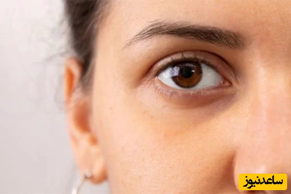 در خانه و فقط در 1 دقیقه؛ با گودی زیر چشم خداحافظی کن