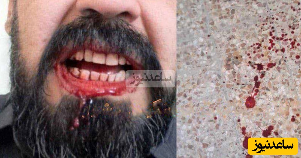 حمله خانواده یک دانش آموز به معلمی در ایلام بعد از تذکر معلم/ آموزش و پرورش پیگیری قضایی را آغاز کرد+ جزئیات